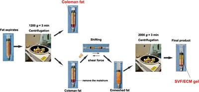 Phenotypic and Cellular Characteristics of a Stromal Vascular Fraction/Extracellular Matrix Gel Prepared Using Mechanical Shear Force on Human Fat